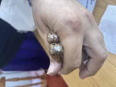 Sağlıklı Kahve Bengal Takım